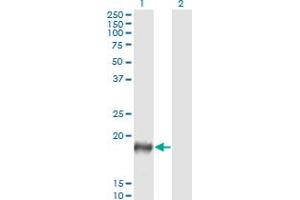 Western Blot analysis of PSCA expression in transfected 293T cell line by PSCA monoclonal antibody (M03), clone 5C2. (PSCA 抗体  (AA 23-95))