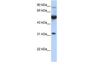 Western Blotting (WB) image for anti-Eukaryotic Translation Initiation Factor 2B, Subunit 1 Alpha, 26kDa (EIF2B1) (C-Term) antibody (ABIN2784713)