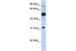WB Suggested Anti-EIF2B1 Antibody Titration: 0. (EIF2B1 抗体  (C-Term))