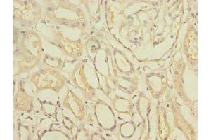 Immunohistochemistry of paraffin-embedded human kidney tissue using ABIN7171935 at dilution of 1:100 (TTC33 抗体  (AA 1-262))
