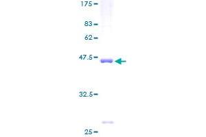 RPS11 Protein (AA 1-158) (GST tag)