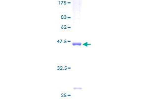 RPS11 Protein (AA 1-158) (GST tag)