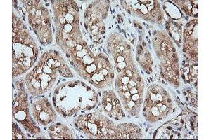 Image no. 2 for anti-Mitogen-Activated Protein Kinase Kinase 1 (MAP2K1) antibody (ABIN1499388) (MEK1 抗体)