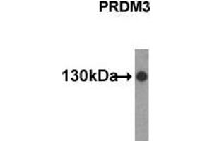 Western Blotting (WB) image for anti-MDS1 and EVI1 Complex Locus (MECOM) (N-Term) antibody (ABIN356376)
