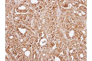 IHC-P Image Immunohistochemical analysis of paraffin-embedded NCI-N87 xenograft, using RPL13A, antibody at 1:100 dilution. (RPL13A 抗体)