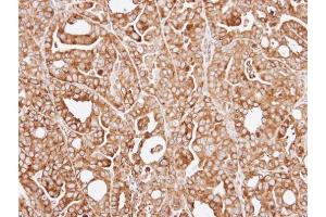 IHC-P Image Immunohistochemical analysis of paraffin-embedded NCI-N87 xenograft, using RPL13A, antibody at 1:100 dilution. (RPL13A 抗体)