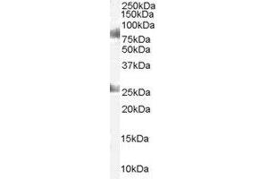 Image no. 1 for anti-Chromodomain Protein, Y-Like (CDYL) (AA 586-598) antibody (ABIN292570) (CDYL 抗体  (AA 586-598))