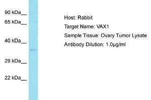 Host: Rabbit Target Name: VAX1 Sample Tissue: Human Ovary Tumor Antibody Dilution: 1ug/ml (VAX1 抗体  (N-Term))