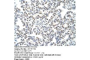 Rabbit Anti-HNRPA3 Antibody  Paraffin Embedded Tissue: Human Lung Cellular Data: Alveolar cells Antibody Concentration: 4. (HNRNPA3 抗体  (N-Term))