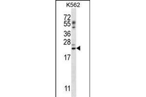 PSORS1C1 Antibody (N-term) (ABIN657118 and ABIN2846264) western blot analysis in K562 cell line lysates (35 μg/lane). (PSORS1C1 抗体  (N-Term))