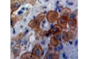 Used in DAB staining on fromalin fixed paraffin-embedded Liver tissue (CXCL11 抗体  (AA 22-94))