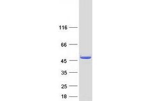 Western Blotting (WB) image for Hydroxymethylbilane Synthase (HMBS) (Transcript Variant 2) protein (Myc-DYKDDDDK Tag) (ABIN2722852)