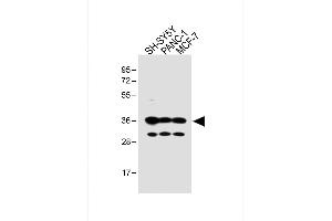 All lanes : Anti-OR5V1 Antibody (C-term) at 1:1000 dilution Lane 1: SH-SY5Y whole cell lysate Lane 2: NC-1 whole cell lysate Lane 3: MCF-7 whole cell lysate Lysates/proteins at 20 μg per lane. (OR5V1 抗体  (C-Term))