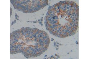 Used in DAB staining on fromalin fixed paraffin- embedded Kidney tissue (KEL 抗体  (AA 439-713))