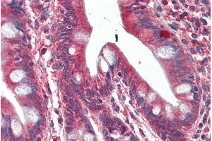 ABIN625816 (5µg/ml) staining of paraffin embedded Human Small Intestine. (SH3GL1 抗体  (Internal Region))