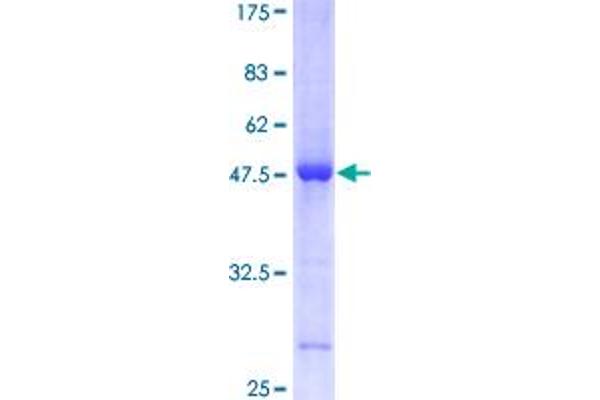 p21 Protein (AA 1-164) (GST tag)