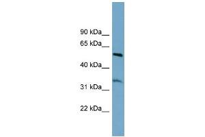 WB Suggested Anti-THNSL2 Antibody Titration: 0. (THNSL2 抗体  (Middle Region))