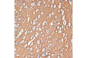 Immunohistochemistry of paraffin-embedded rat brain using Syntaxin Rabbit mAb (ABIN7270685) at dilution of 1:100 (40x lens).