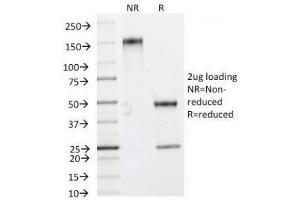 SDS-PAGE Analysis of Purified, BSA-Free HSP27 Antibody (clone HSPB1/774). (HSP27 抗体)