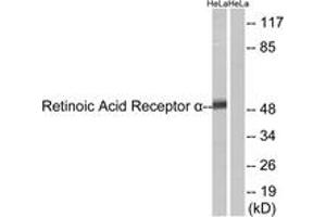 Western blot analysis of extracts from HeLa cells, using Retinoic Acid Receptor alpha (Ab-77) Antibody.