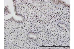 Immunoperoxidase of purified MaxPab antibody to TOB1 on formalin-fixed paraffin-embedded human endometrium. (Protein Tob1 (TOB1) (AA 1-345) 抗体)