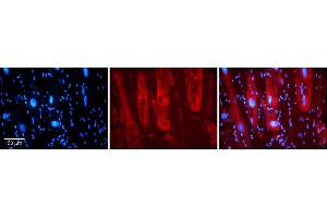 Rabbit Anti-SIRT5 Antibody    Formalin Fixed Paraffin Embedded Tissue: Human Adult heart  Observed Staining: Cytoplasmic Primary Antibody Concentration: 1:600 Secondary Antibody: Donkey anti-Rabbit-Cy2/3 Secondary Antibody Concentration: 1:200 Magnification: 20X Exposure Time: 0. (SIRT5 抗体  (Middle Region))