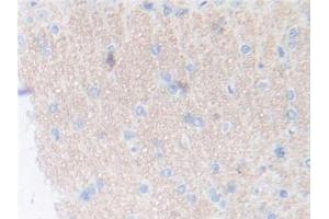 DAB staining on IHC-P; Samples: Rat Cerebrum Tissue (Thrombopoietin 抗体  (AA 24-266))