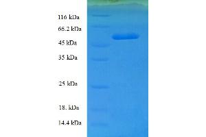 SDS-PAGE (SDS) image for General Transcription Factor IIB (GTF2B) (AA 1-316), (full length) protein (His-SUMO Tag) (ABIN5709623) (GTF2B Protein (AA 1-316, full length) (His-SUMO Tag))