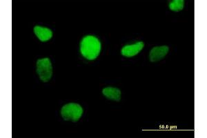 Immunofluorescence of purified MaxPab antibody to ZFP161 on HeLa cell. (ZBTB14/ZFP161 抗体  (AA 1-449))