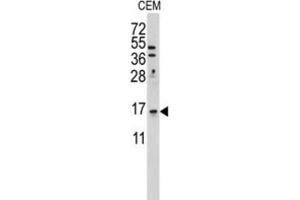 Western Blotting (WB) image for anti-LSM1 Homolog, U6 Small Nuclear RNA Associated (LSM1) antibody (ABIN3001679) (LSM1 抗体)