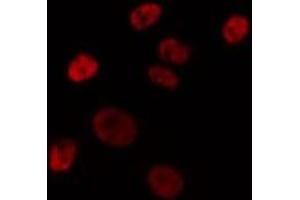ABIN6275742 staining HepG2 by IF/ICC. (Elf4 抗体  (Internal Region))