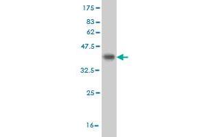 Western Blot detection against Immunogen (35. (CDK8 抗体  (AA 375-464))