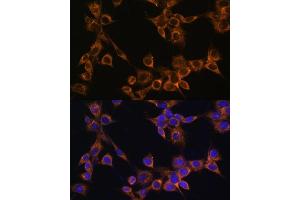 Immunofluorescence analysis of NIH/3T3 cells using R antibody (ABIN6132582, ABIN6146672, ABIN6146673 and ABIN6222096) at dilution of 1:100. (RAMP1 抗体  (AA 27-117))