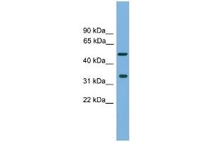 CFDP1 antibody used at 1 ug/ml to detect target protein. (CFDP1 抗体  (Middle Region))