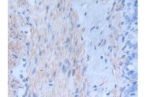 Detection of INHbA in Rat Intestine Tissue using Monoclonal Antibody to Inhibin Beta A (INHbA) (INHBA 抗体  (AA 314-424))