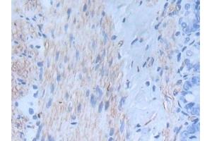 Detection of INHbA in Rat Intestine Tissue using Monoclonal Antibody to Inhibin Beta A (INHbA)