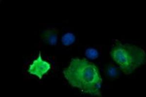 Image no. 2 for anti-Cancer/testis Antigen 1B (CTAG1B) antibody (ABIN1499901) (CTAG1B 抗体)