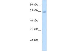 Western Blotting (WB) image for anti-Steroid Sulfatase (Microsomal), Isozyme S (STS) antibody (ABIN2462461) (STS 抗体)