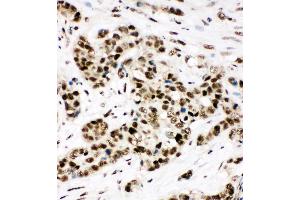 Anti-Ku80 antibody,  IHC(P) IHC(P): Human Lung Cancer Tissue Lysate