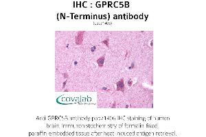 Image no. 1 for anti-G Protein-Coupled Receptor, Family C, Group 5, Member B (GPRC5B) (Extracellular Domain), (N-Term) antibody (ABIN1735216)