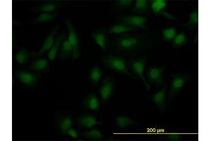 Immunofluorescence of monoclonal antibody to NR1H2 on HeLa cell. (NR1H2 抗体  (AA 1-461))