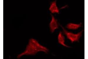 Immunofluorescence (fixed cells) (IF/ICC) image for anti-Glutamate Receptor, Ionotropic, N-Methyl D-Aspartate 2D (GRIN2D) (Internal Region) antibody (ABIN6258225)