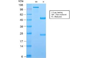 SDS-PAGE Analysis Purified TCL1 Recombinant Rabbit Monoclonal Antibody (TCL1/2747R). (Recombinant TCL1A 抗体  (AA 2-109))