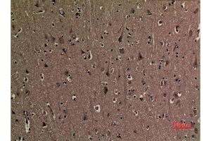 Immunohistochemistry (IHC) analysis of paraffin-embedded Human Brain, antibody was diluted at 1:100. (p53 抗体  (2meLys370))