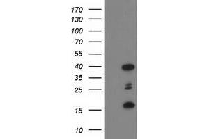 Western Blotting (WB) image for anti-PDZ and LIM Domain 2 (PDLIM2) antibody (ABIN1500124) (PDLIM2 抗体)