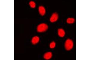 Immunofluorescent analysis of 53BP1 staining in HeLa cells. (TP53BP1 抗体  (N-Term))