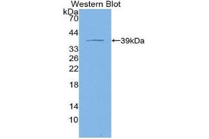 Western Blotting (WB) image for anti-Keratin 4 (KRT4) (AA 152-457) antibody (ABIN1859579) (KRT4 抗体  (AA 152-457))