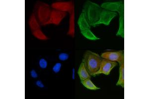 ABIN6258446 and ABIN6274906 staining Hela cells(30 min of UV treatment) by IF/ICC. (B3GALTL 抗体  (C-Term))