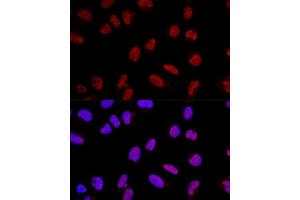 Confocal immunofluorescence analysis of U2OS cells using  Polyclonal Antibody (ABIN3017254, ABIN3017255, ABIN3017256 and ABIN6220015) at dilution of 1:200. (AKAP8 抗体  (AA 480-692))