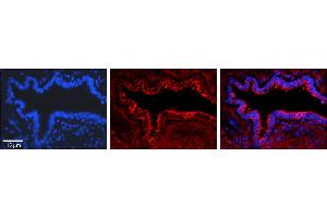 Rabbit Anti-PA2G4 Antibody     Formalin Fixed Paraffin Embedded Tissue: Human Bronchial Epithelial Tissue  Observed Staining: Cytoplasmic  Primary Antibody Concentration: 1:100  Secondary Antibody: Donkey anti-Rabbit-Cy3  Secondary Antibody Concentration: 1:200  Magnification: 20X  Exposure Time: 0.